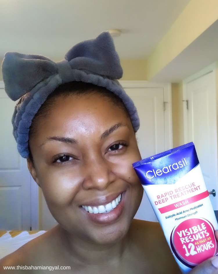 Beauty blogger, Rogan Smith shows off her clear skin after using the Clearasil Rapid Rescue Deep Treatment face wash.