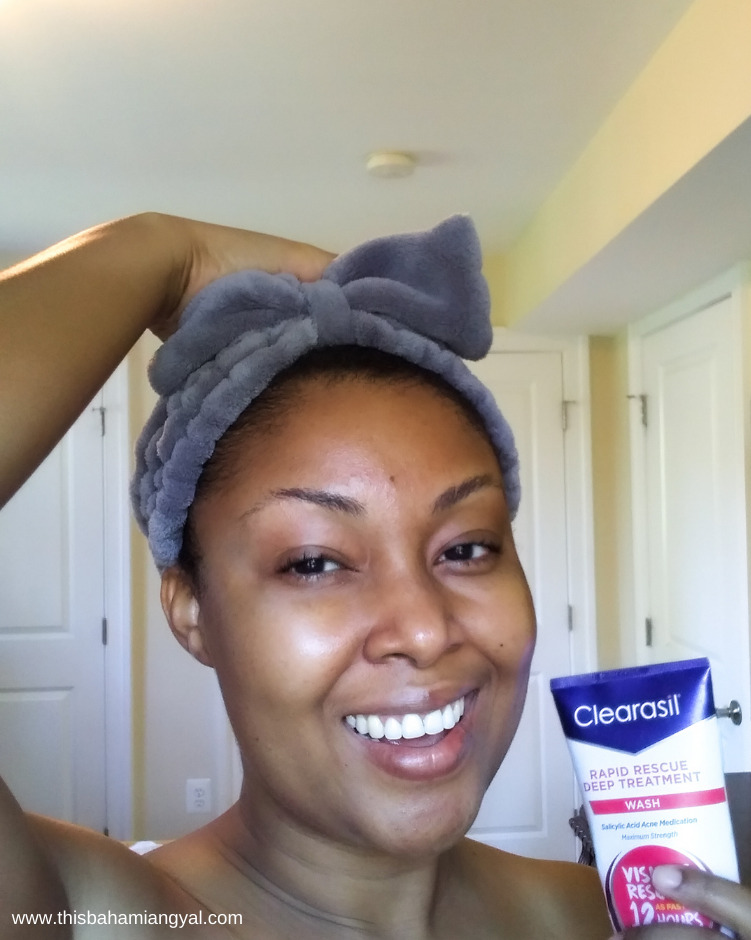 Beauty blogger, Rogan Smith smiles as she shows off her clear skin after using the Clearasil Rapid Rescue Deep Treatment face wash.